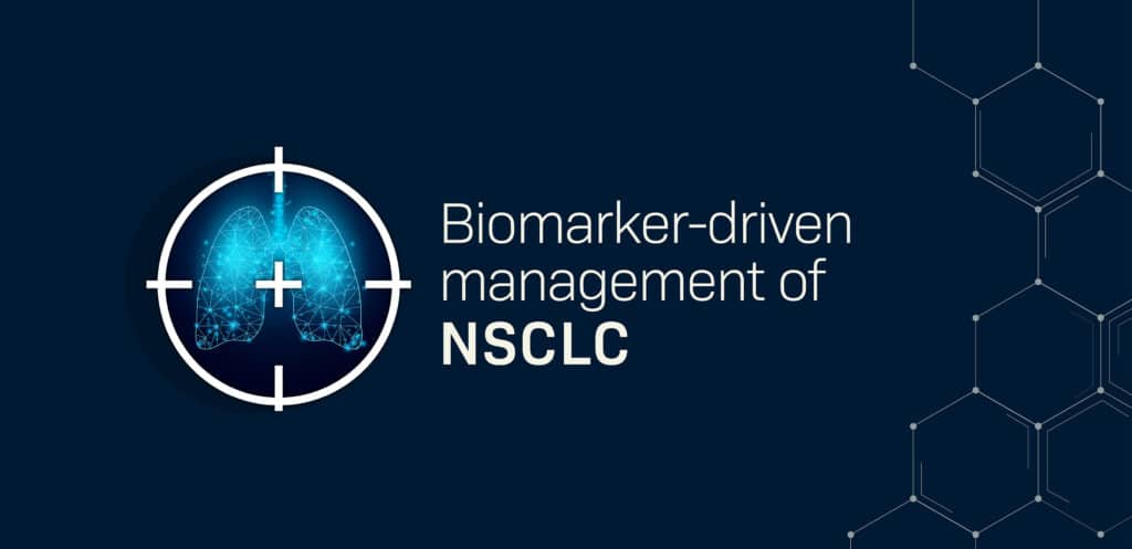 Logo for the ‘Biomarker-driven management of NSCLC program’ featuring the program name in bold blue letters and a small circular icon with lungs to the left of the text